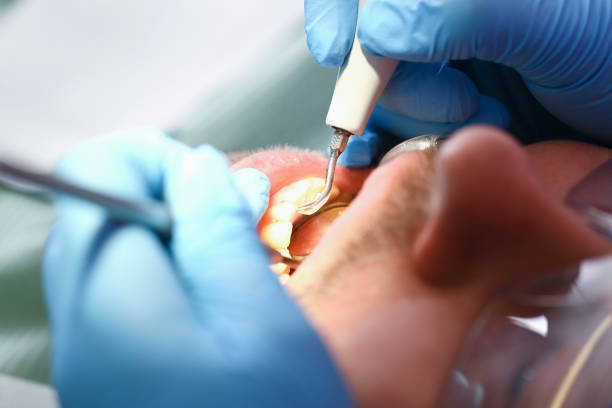 Best Pediatric Emergency Dentist in Landover Hills, MD