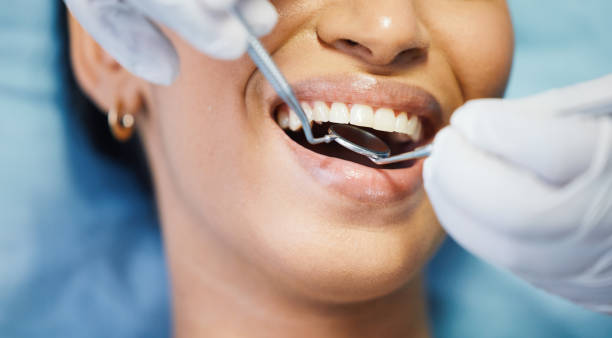 Best Emergency Root Canal Treatment in Landover Hills, MD